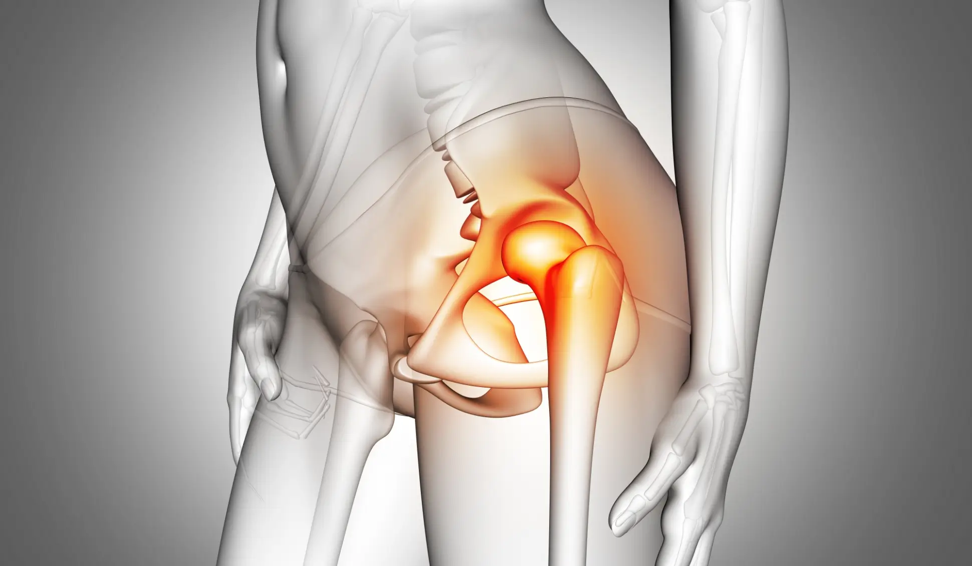 artroplastia de resurfacing como funciona
