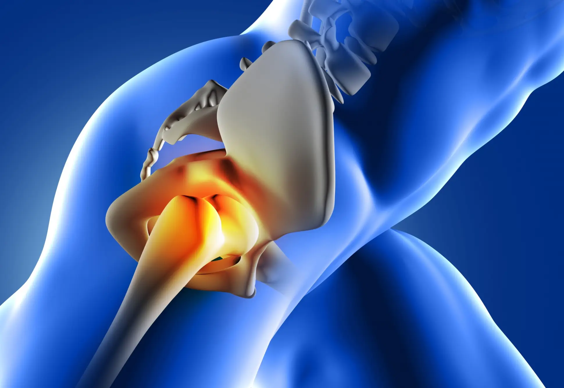 artroplastia de resurfacing pelo plano de saúde